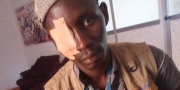 Guinée : Agressions physique et…de menaces de mort contre le journaliste, Oumar OC CISSÉ