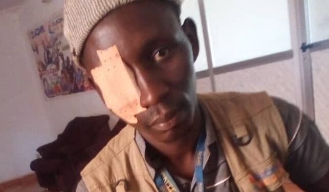 Guinée : Agressions physique et…de menaces de mort contre le journaliste, Oumar OC CISSÉ