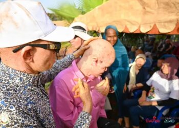 Guinée : Des kits de protection solaire aux personnes atteintes d&rsquo;albinisme de Kankan