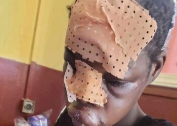 Guinée/Santé : Une jeune fille violemment agressée pour avoir interrompu une grossesse