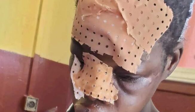 Guinée/Santé : Une jeune fille violemment agressée pour avoir interrompu une grossesse