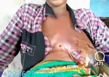 Guinée : SOS pour Oumou Hawa Diallo, âgée de 27 ans et mère de deux enfants