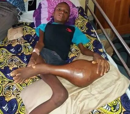 Guinée : SOS pour Mamadou Aliou Bah qui traîne une grave maladie depuis plus de 5 mois