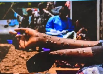 Incendie de l&rsquo;entrepôt du PEV/Lutte contre le Mpox : Les acteurs du système de Santé en concertation