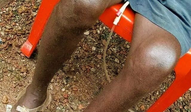 Conakry : Fodé Momo Bangoura, mécanicien brisé par la vie, lance un appel à l’aide