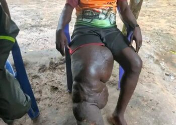 Guinée/Santé : Appel urgent pour un frère en détresse