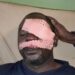 Conakry : Un journaliste sportif victime d&rsquo;une agression barbare perd son œil gauche