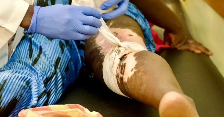 Guinée : Démarrage des activités de la mission Orthopédique-pédiatrique l’ONG Les Enfants de Noma