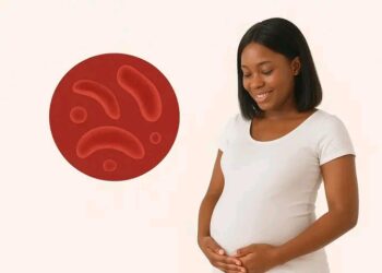 Guinée – Drépanocytose : Un test prénuptial pour protéger nos enfants