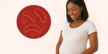 Guinée – Drépanocytose : Un test prénuptial pour protéger nos enfants