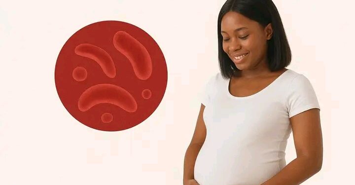Guinée – Drépanocytose : Un test prénuptial pour protéger nos enfants