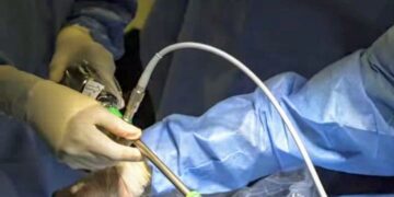 Conakry / Chirurgie pédiatrique : Un cas complexe pris en charge par la mission Codomo