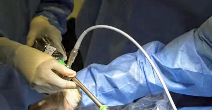 Conakry / Chirurgie pédiatrique : Un cas complexe pris en charge par la mission Codomo