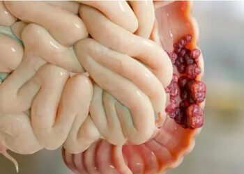 Guinée – Mars Bleu : Les signes qui doivent alerter