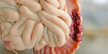 Guinée – Mars Bleu : Les signes qui doivent alerter