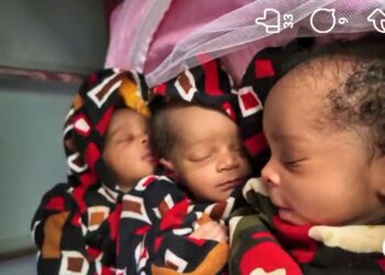 🇬🇳N’Zérékoré : Une naissance exceptionnelle et un appel à la solidarité