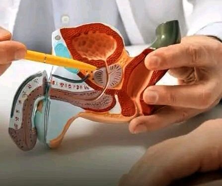 🇬🇳Cancer de la prostate : Les signaux d’alerte à ne pas négliger