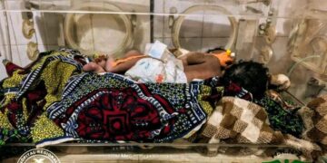🇬🇳Naissance de bébés siamois à N’Zérékoré