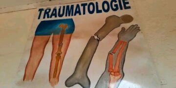 🇬🇳Kankan : Le service de traumatologie et d’orthopédie réduit les évacuations sanitaires