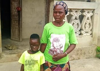 🇬🇳Santé publique : Un appel à l’aide pour le petit Pépé Kpoghomou, victime de graves brûlures à Yomou