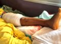 🇬🇳Kankan : L’Orthopédie-Traumatologie au service des soins spécialisés