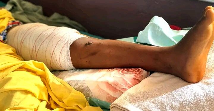 🇬🇳Kankan : L’Orthopédie-Traumatologie au service des soins spécialisés