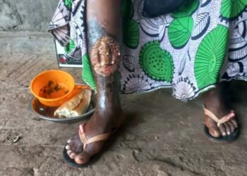 🇬🇳Santé : Appel à la solidarité pour Fadima Bah, ancienne journaliste de Planète FM