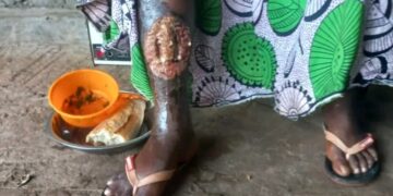 🇬🇳Santé : Appel à la solidarité pour Fadima Bah, ancienne journaliste de Planète FM