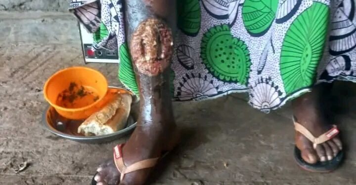 🇬🇳Santé : Appel à la solidarité pour Fadima Bah, ancienne journaliste de Planète FM